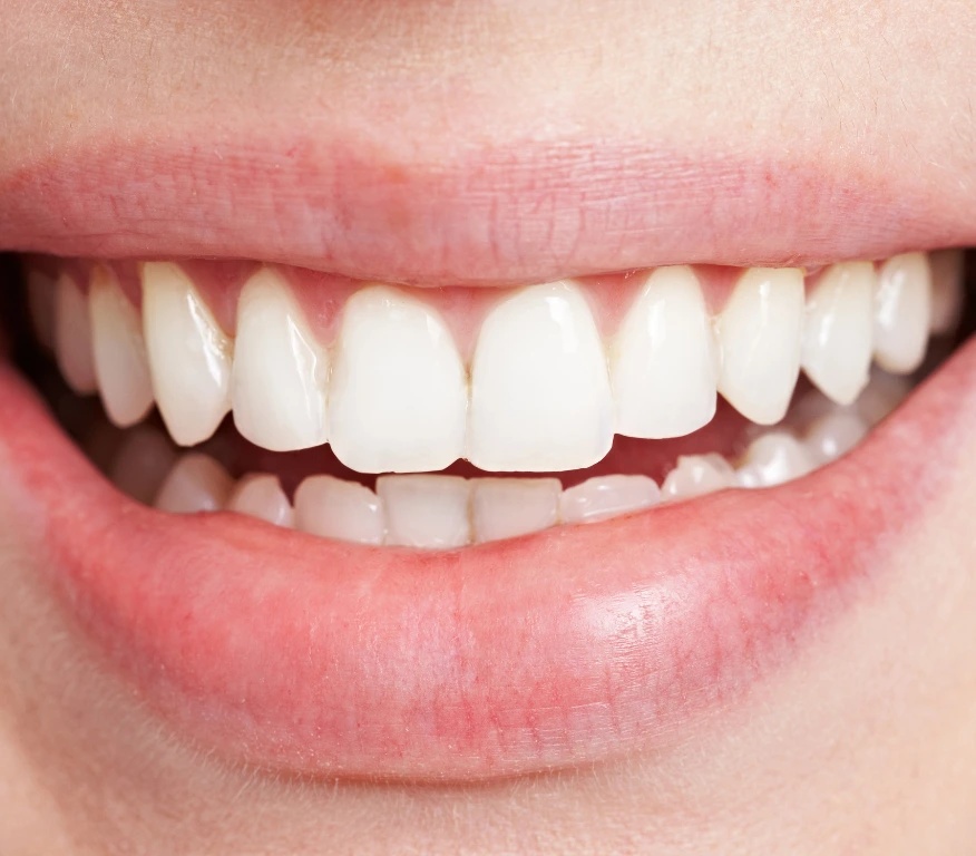 Modern zirconium dentistry in Turkey