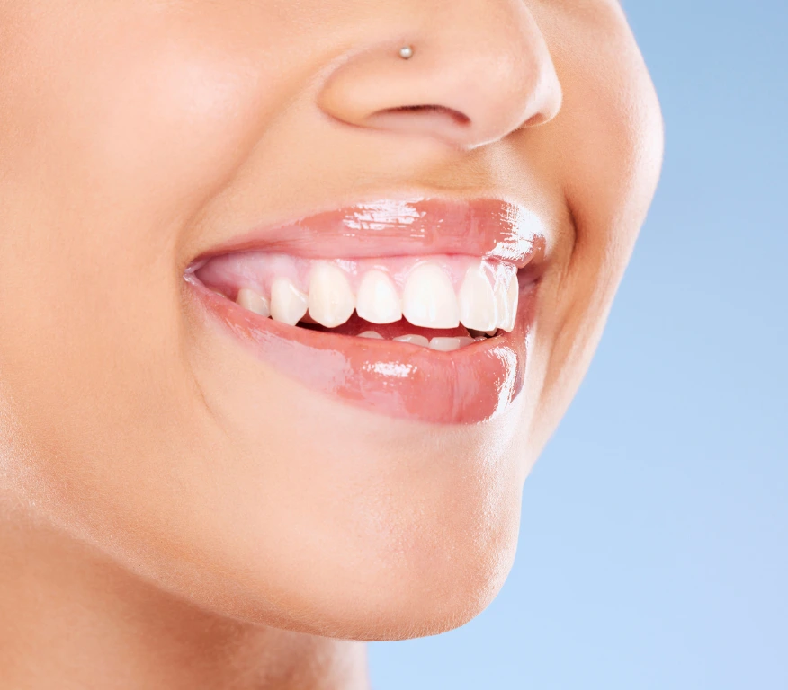 Before and after results of zirconium crowns in Turkey
